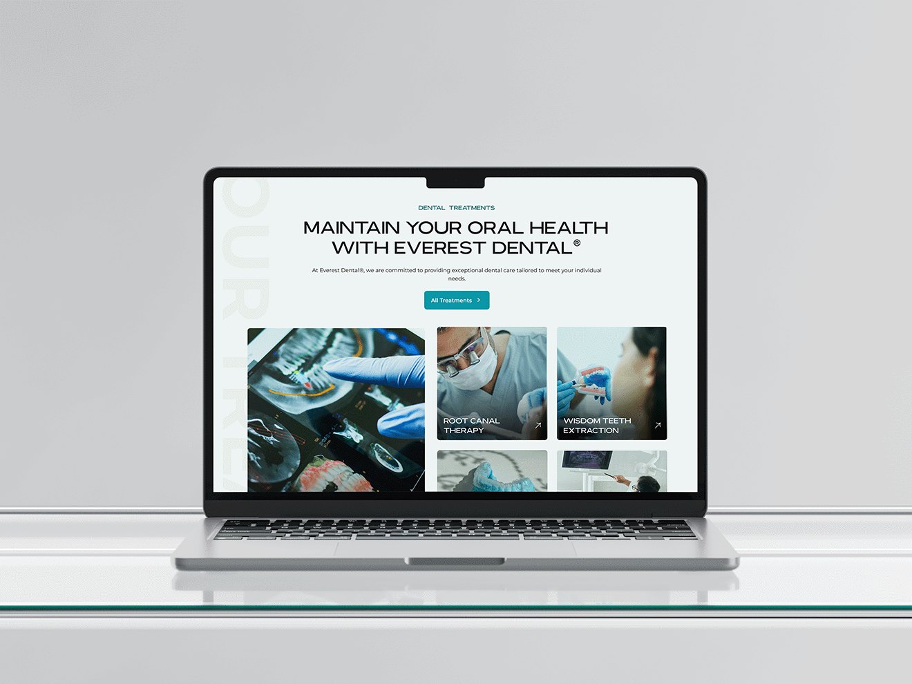Everest Dental treatments page on a laptop